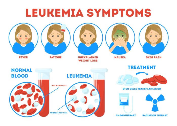 Do i have leukemia quiz